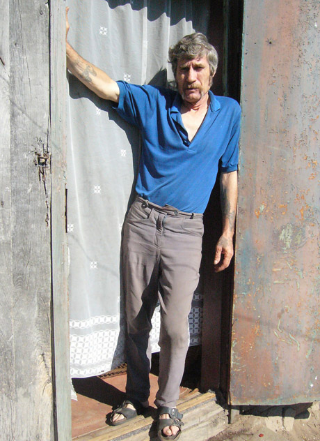 Žaibo pakirstas vyras jau vaikšto